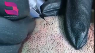 ریش کم تراکم!!!