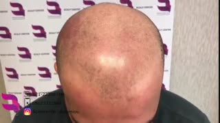 اسکالپ اسپرت