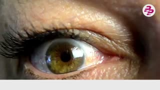 10نشانه دیابت که باید جدی گرفت