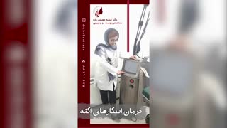 درمان اسکار های اکنه