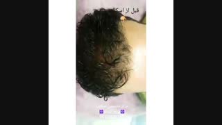 اسکالپ آقایان