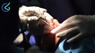 فیلم عمل ترمیم بینی