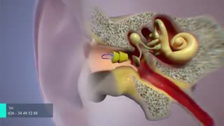 نحوه کار کردن سمعک