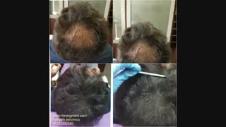 کربردهای استفاده از اسکالپ سر