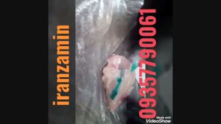 آموزش تزریق چربی کامل ☝ایران زمین 09357790061