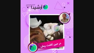 عمل کاشت ریش