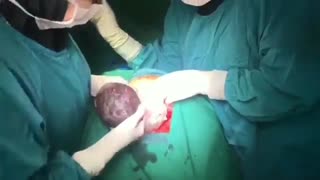 فیلم زایمان سزارین تکراری