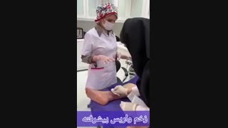 درمان زخم واریس پا - دکتر فریبا هندسی ترمیم دندان