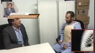 فیلم رفع قوز پشتى از نمای نزدیک