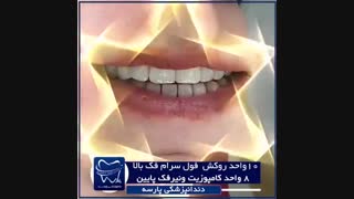 ۱۰ واحد روکش فول سرام فک بالا