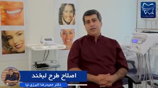 اصلاح طرح لبخند