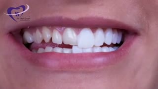 رنگ دندانها متنوع هستند | دکتر فاضل فیروزی
