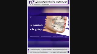 انواع درمان ها و دستگاههای ارتودنسی | دکتر فاضل فیروزی