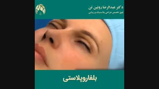 بلفاروپلاستی | فوق تخصص جراحی پلاستیک | دکتر عبدالرضا روئین تن