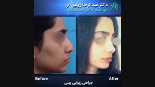 جراحی زیبایی بینی | فوق تخصص جراحی پلاستیک | دکتر عبدالرضا روئین تن