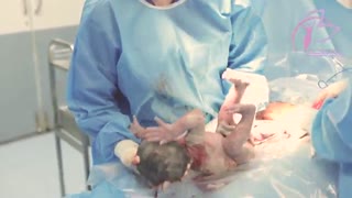 فیلم زایمان سزارین واقعی و زیبا