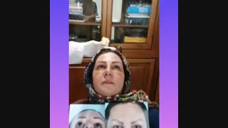 فیلم واقعی از عمل بینی گوشتی