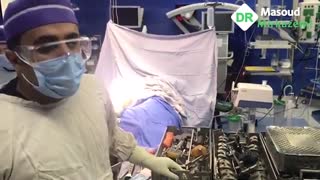 فیلم واقعی جراحی پروتز زانو