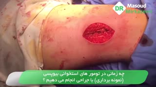 چه زمانی در تومورهای استخوانی بیوپسی با جراحی انجام می دهیم؟