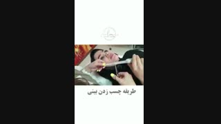 نحوه چسب زدن به بینی
