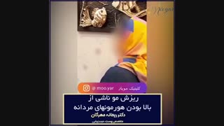 ریزش مو ناشی از هورمون مردانه