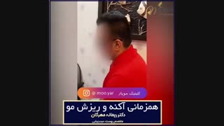 همرمانی ریزش مو و آکنه