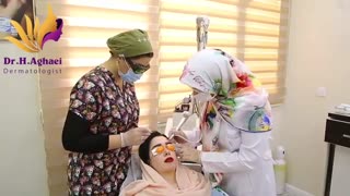 فیلم برداشتن خال و کک و مک با لیزر