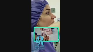 فیلم واقعی عمل بینی نیمه گوشتی