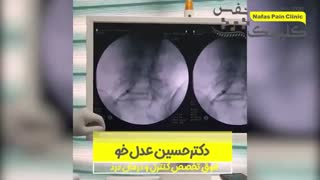 درمان دردهای بعد از  عمل دیسک کمر