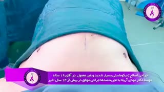 جراحی اصلاح ژنیکوماستی بسیار شدید و غیر معمول در آقای 19 ساله