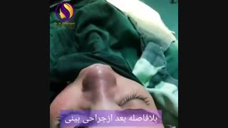 عمل جراحی زیبایی بینی