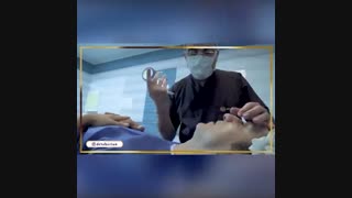 فیلم جراحی شکستگی بینی و عمل زیبایی