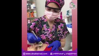 انجام درماالکسی در کلینیک دکتر صابرراد
