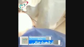 جراحی در آوردن دو دندان نیش نهفته
