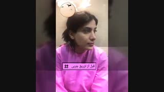 فیلم قبل از تزریق چربی