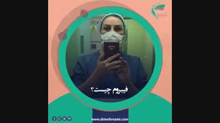 فیبروم رحم