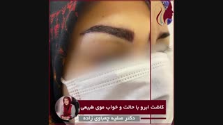 فیلم واقعی کاشت ابرو با حالت و خواب موی طبیعی