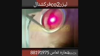 فیلم کاربرد لیزر co2 فرکشنال برای مشکلات پوستی