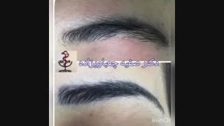 فیلمی از نمونه های واقعی لیزر تاتو ریموال ابرو