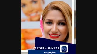 8 واحد ونیرکامپوزیت فک بالا  در کلینیک دندان پزشکی پارسه