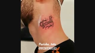 کلینیک تاتو ایران | 09126130533