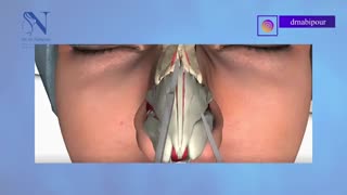 فیلم انیمیشن جراحی زیبایی بینی