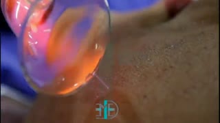 دستگاه ED-DBD PLASMA