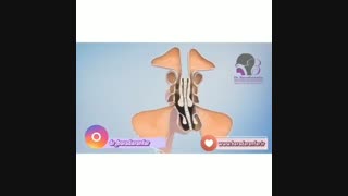 فیلم نحوه درمان سینوزیت