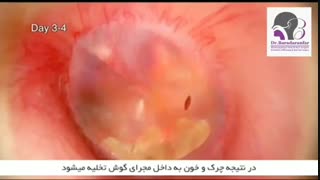 فیلم عفونت گوش