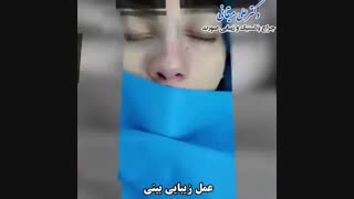 فیلم عمل زیبایی بینی