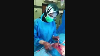 فیلم عمل هیسترکتومی (خارج کردن رحم)