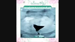 عکس رنگی رحم