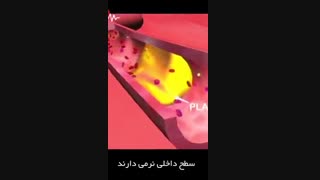 انیمیشن سکته قلبی