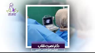 فیلم عمل پانکچر برای سیکل ivf